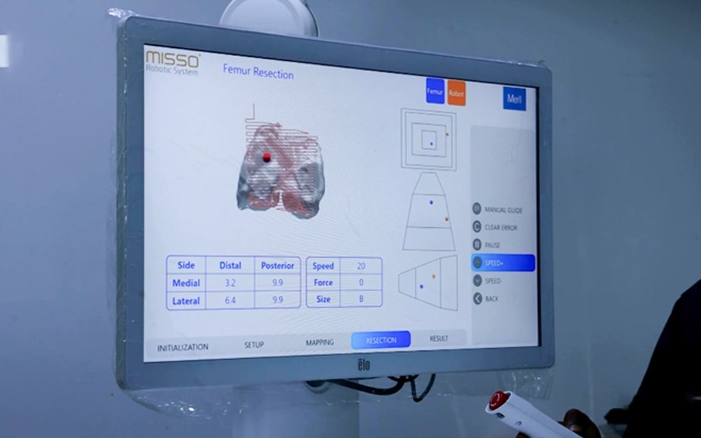 3d printing orthopedic implants