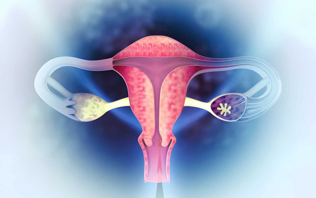Diagnostic Methods to Identify Endometriosis in Women