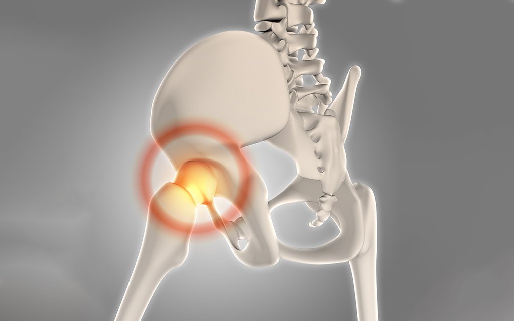 hip joint injuries