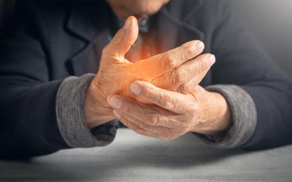 rheumatoid arthritis