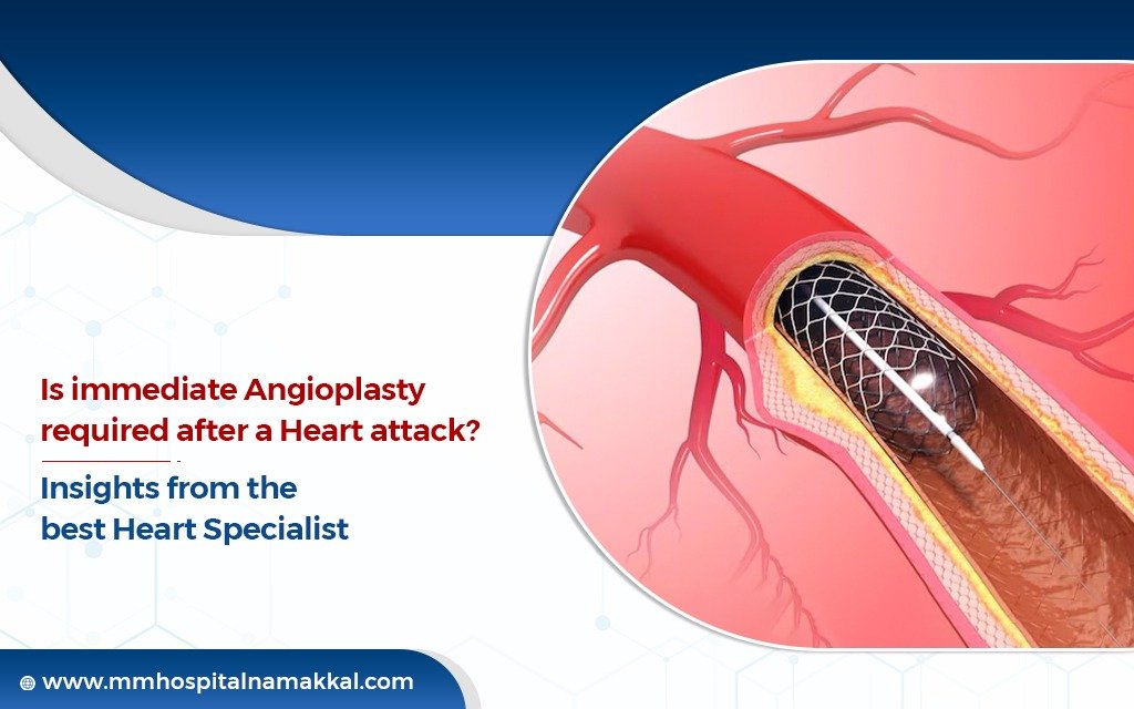 angioplasty