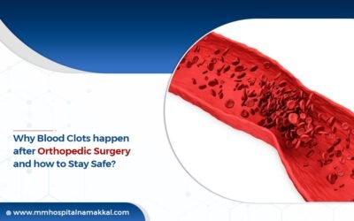 Why Blood Clots Happen After Orthopedic Surgery – And How to Stay Safe
