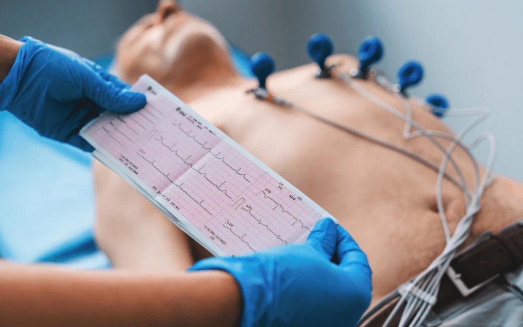 ecg procedure