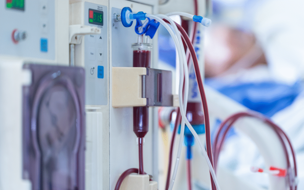 dialysis procedure