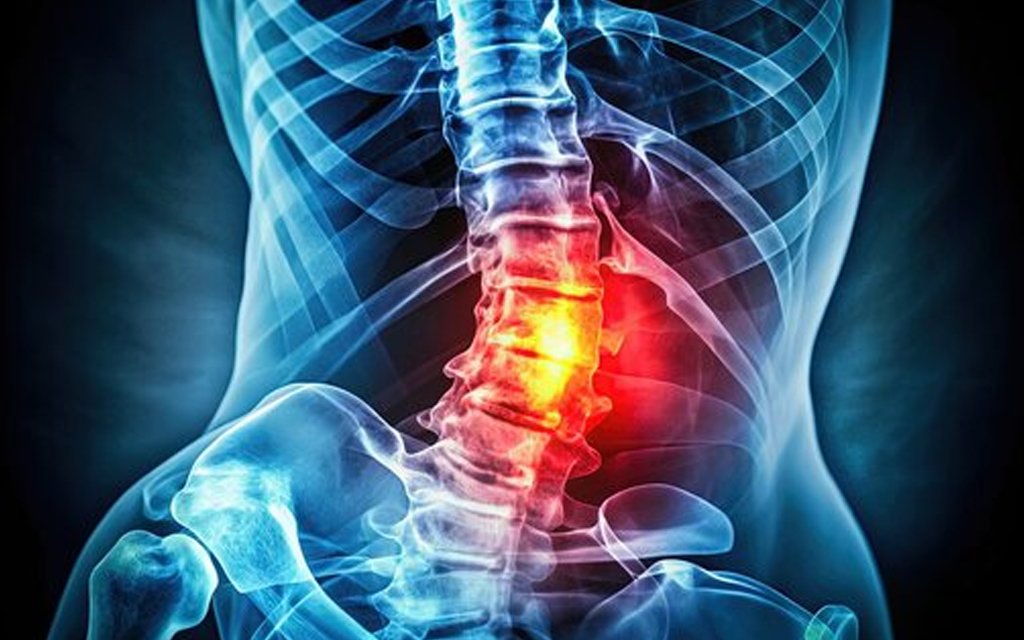 spine injury