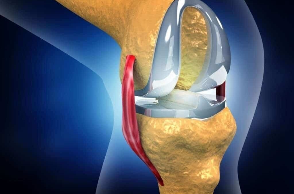 Knee Replacement Surgery