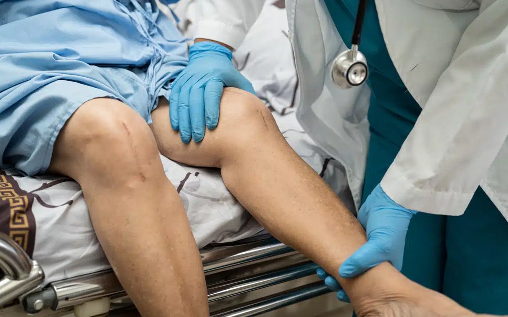 traditional knee replacement